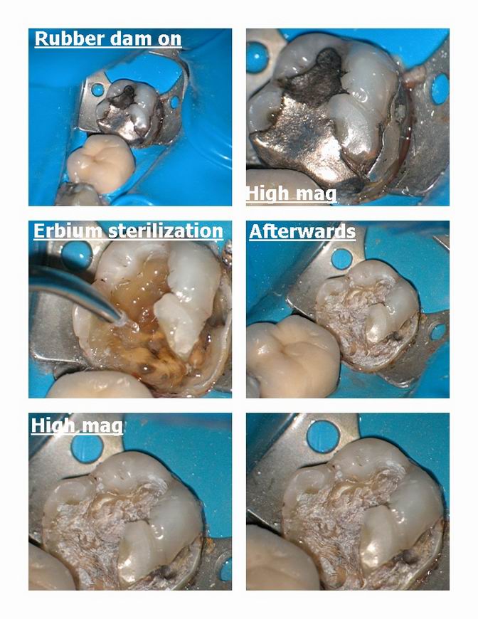 Resize of 2 laser case pg 2.jpg